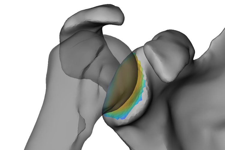 CT scan of a human shoulder joint